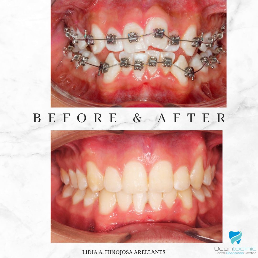 Lidia Abigail Hinojosa Arellanes-9