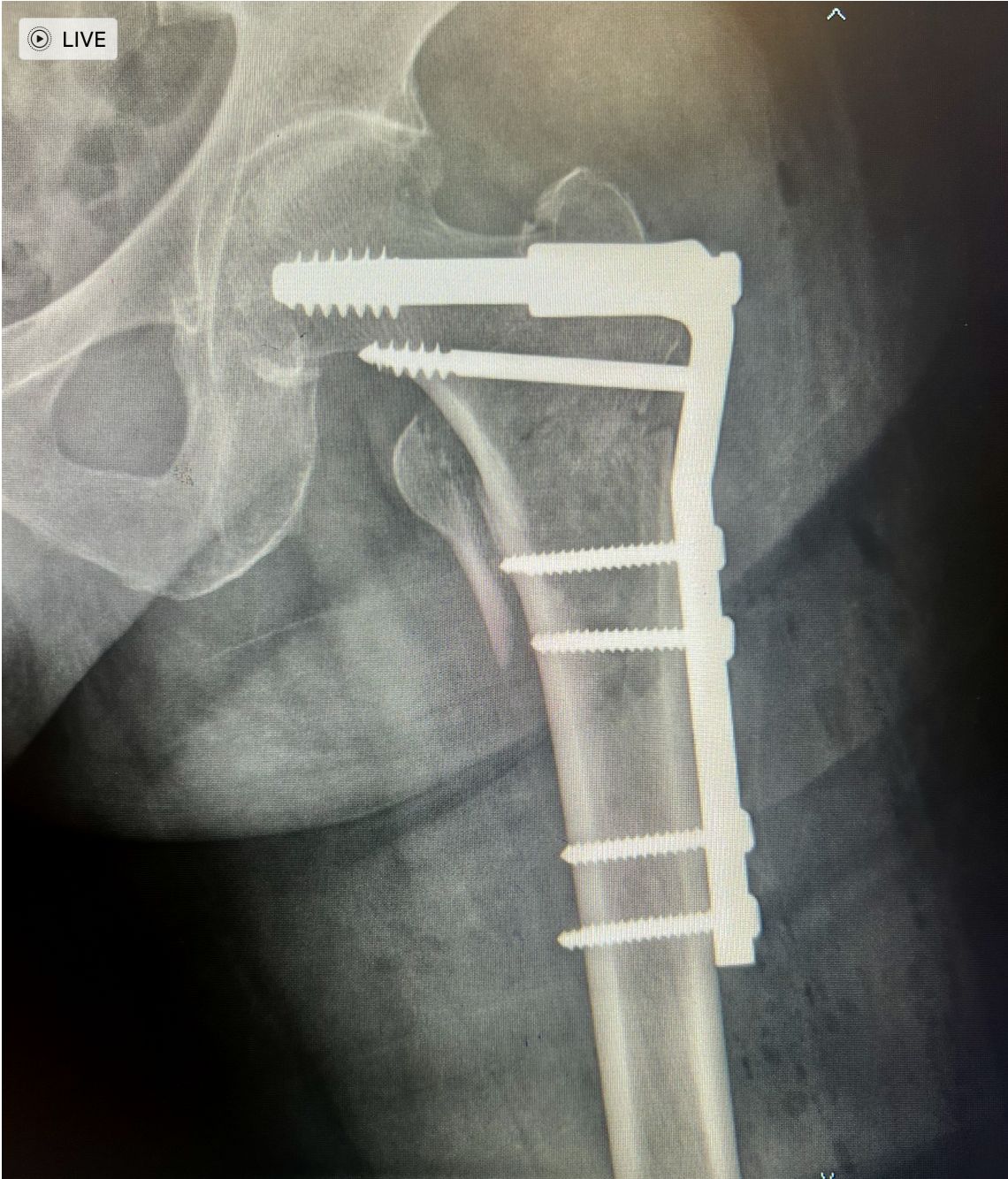 Manuel De Jesús Ambrosio Vicente-6