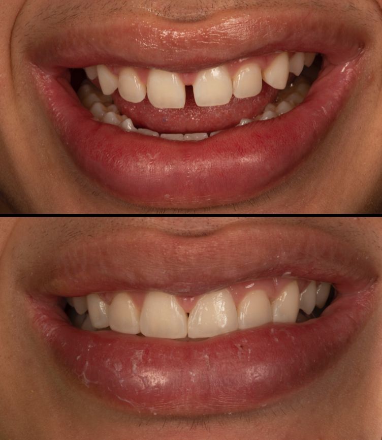 María Fernanda González Gastelum-21