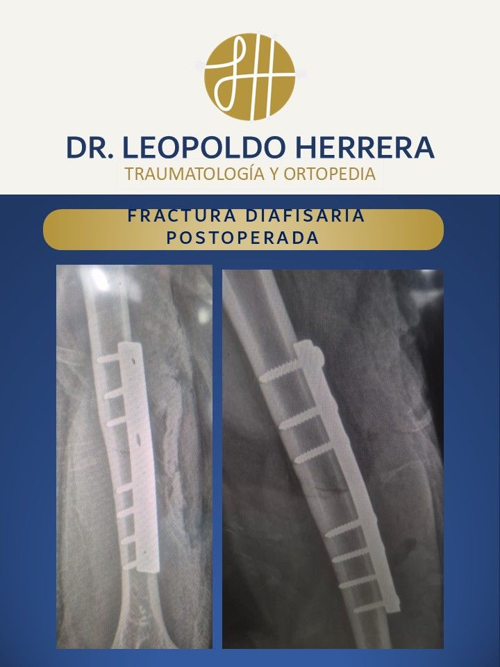 Leopoldo José Herrera Camacho-15