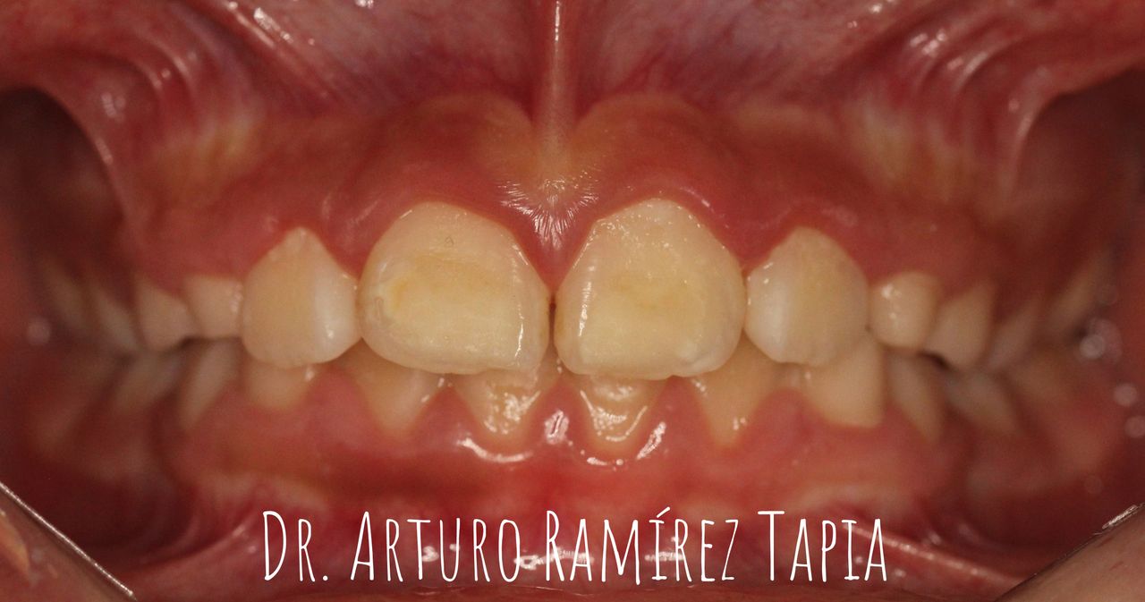 Arturo Ramírez Tapia-19