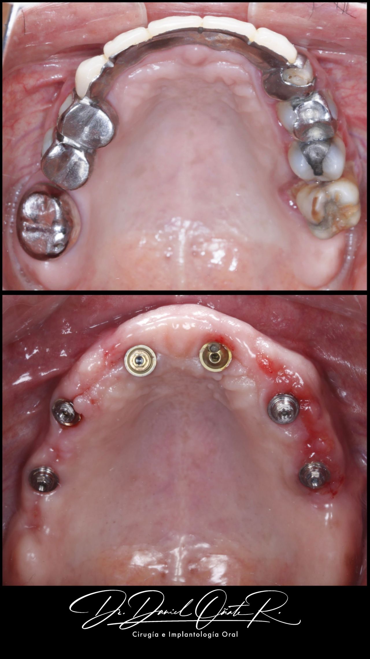 Daniel Oñate Robledo-5