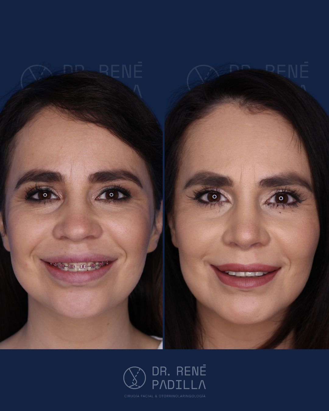 René E. Padilla López-31