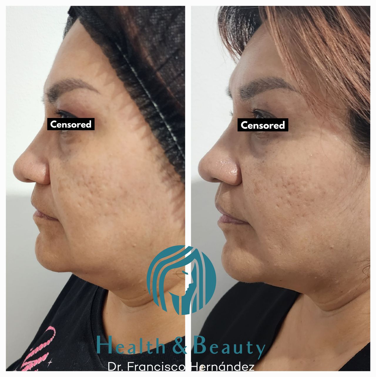 Francisco Hernández Gómez Crespo-71