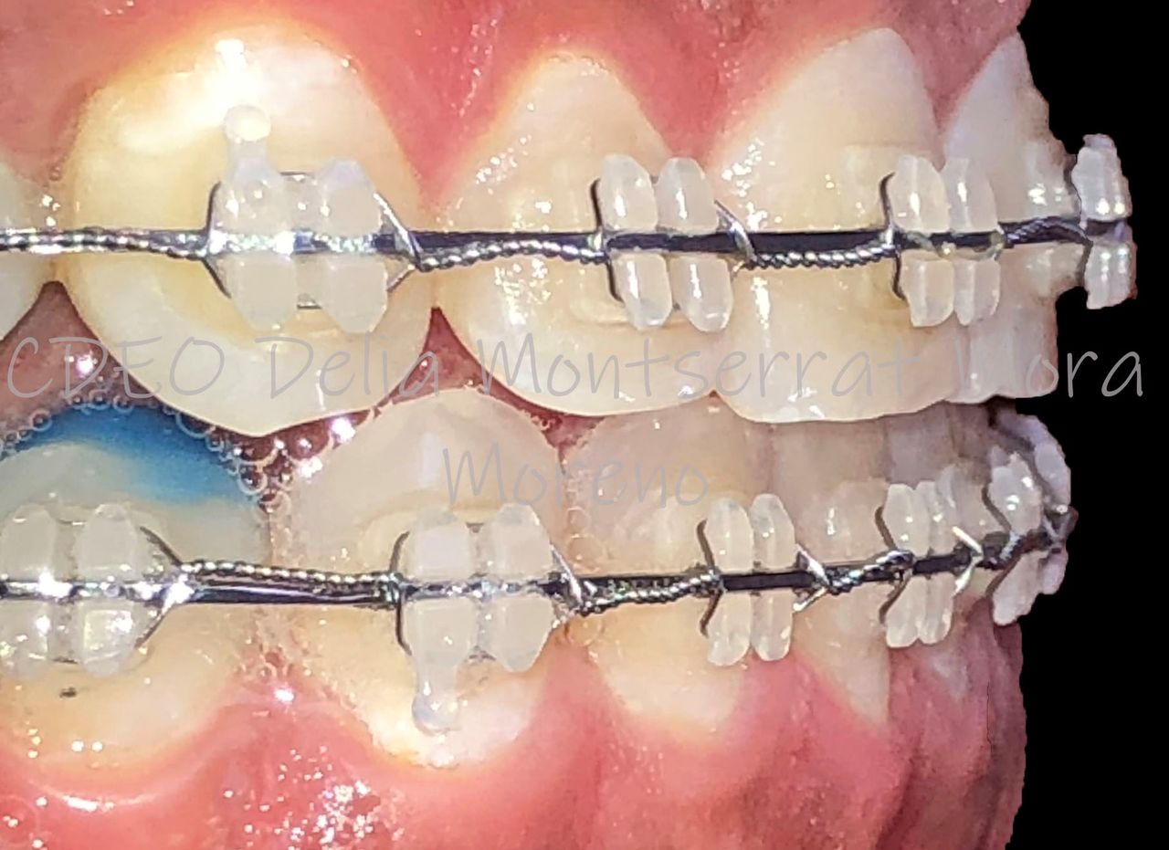 Delia Montserrat Mora Moreno-6