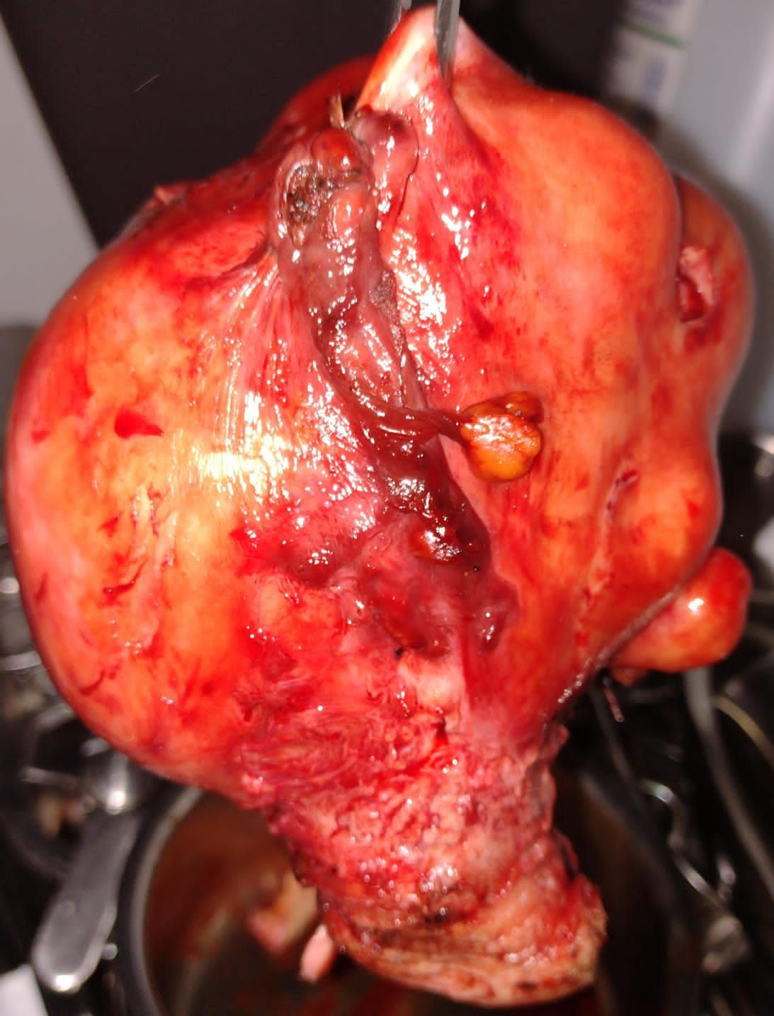 Abraham Ignacio Pérez De La Rosa-15