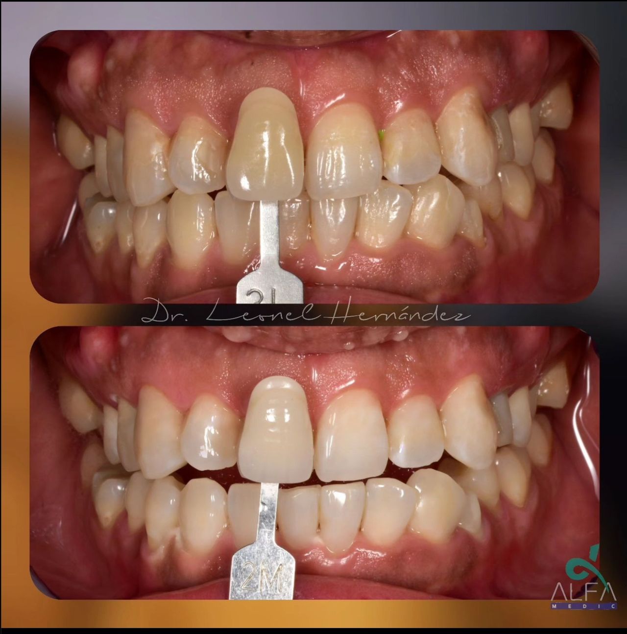 Leonel Hernández Gómez-10