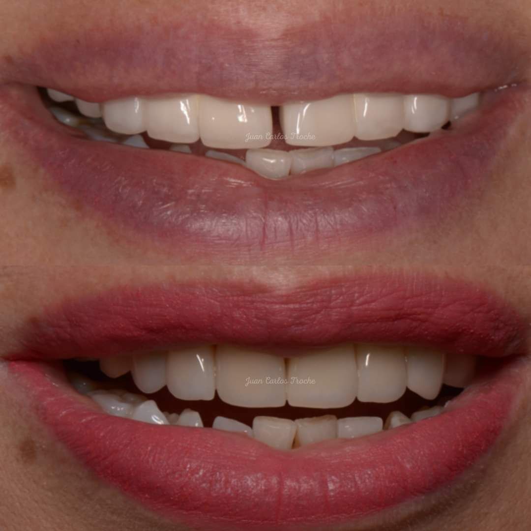 Juan Carlos Troche Chavez-7