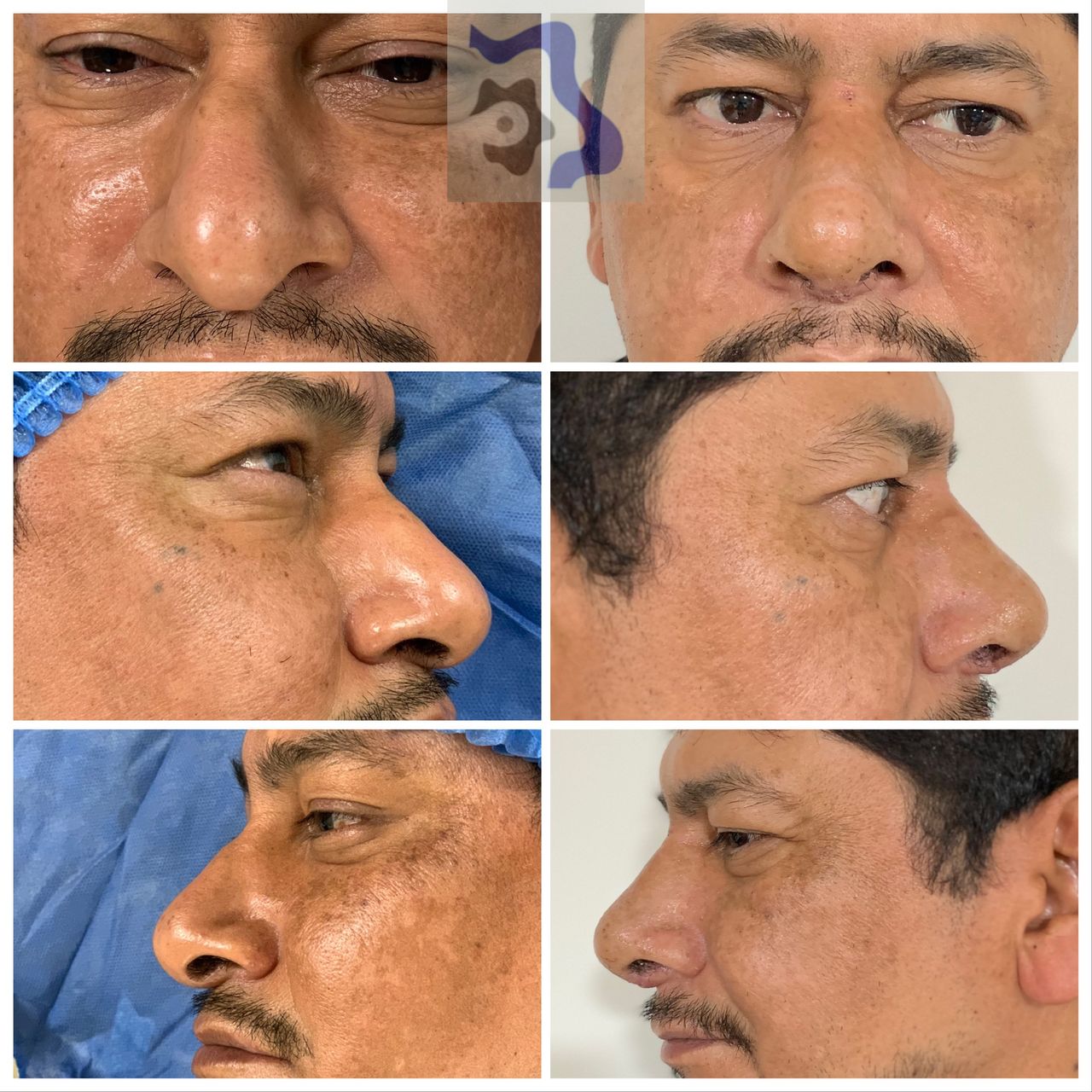 Cesar Alfonso Gutierrez Espinosa-5