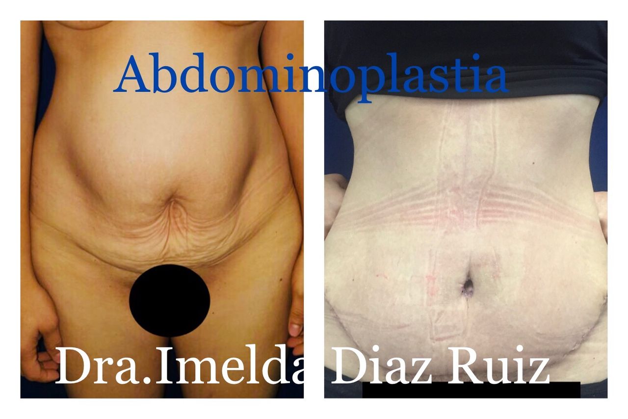 Imelda Díaz Ruiz-13