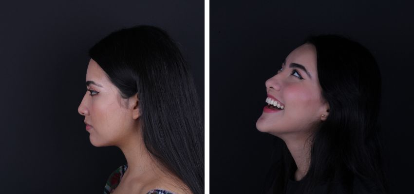 Federico Suastegui Carmona-3