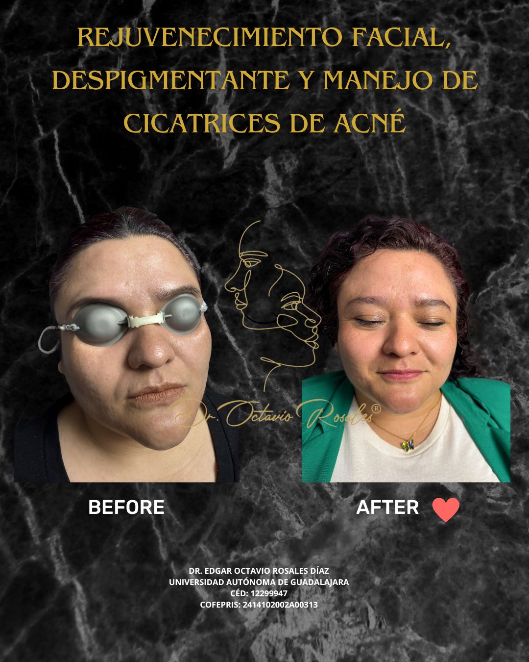 Edgar Octavio Rosales Diaz-18