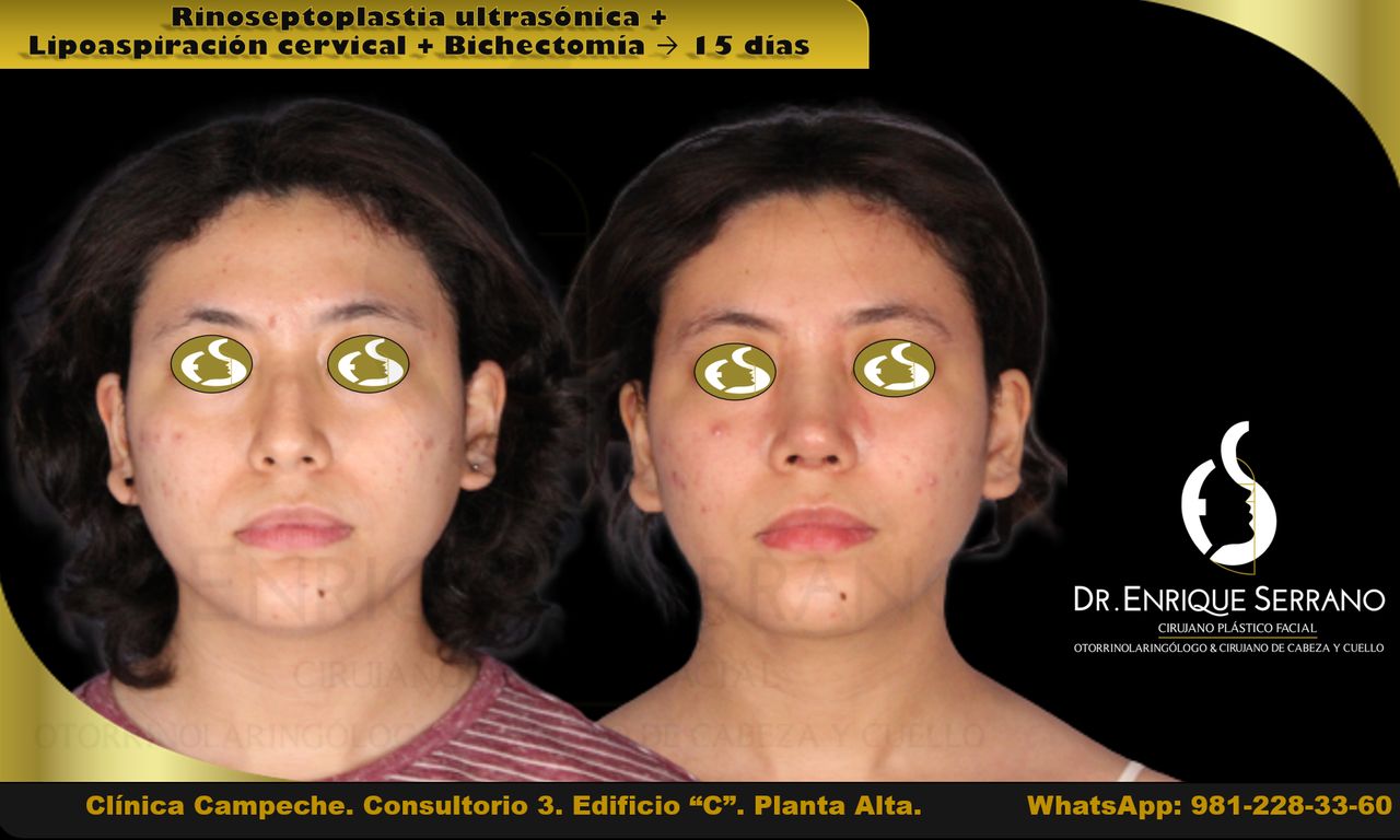 Enrique Serrano Cruz-23