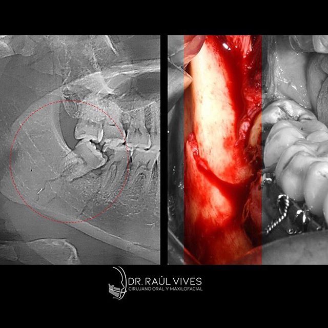 Raúl José Vives Serrano-2