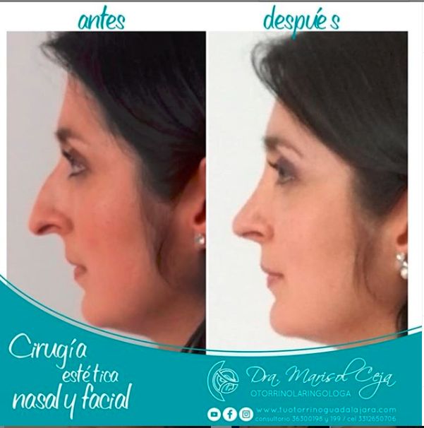 Marisol Ceja Zepeda-49