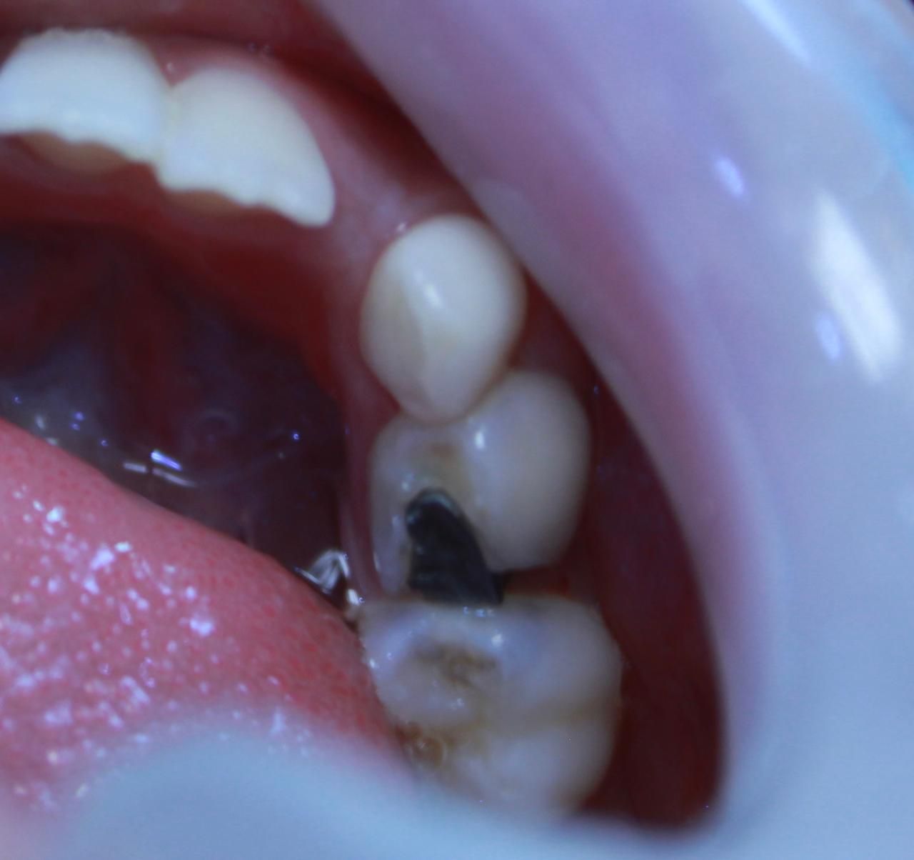 Jonathan Ortiz Zorraquin-10