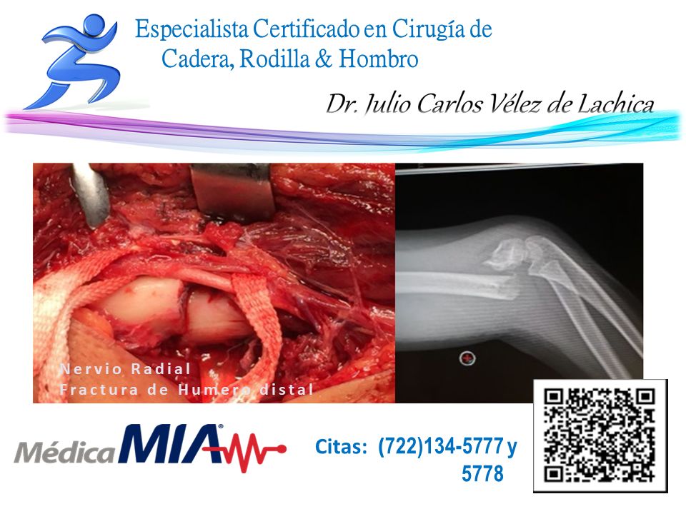 Julio Carlos Vélez De Lachica-38