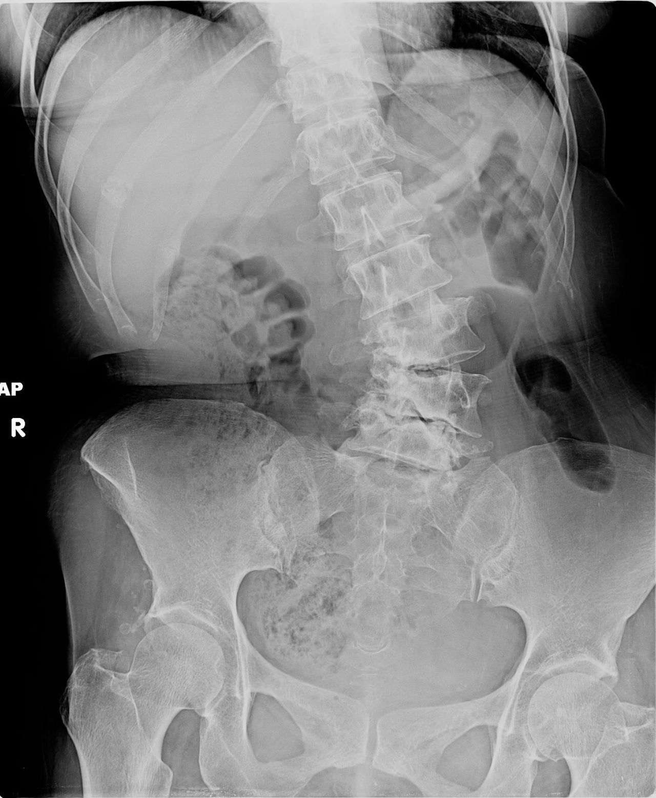 Lizeth Patricia Mena Rivas-30