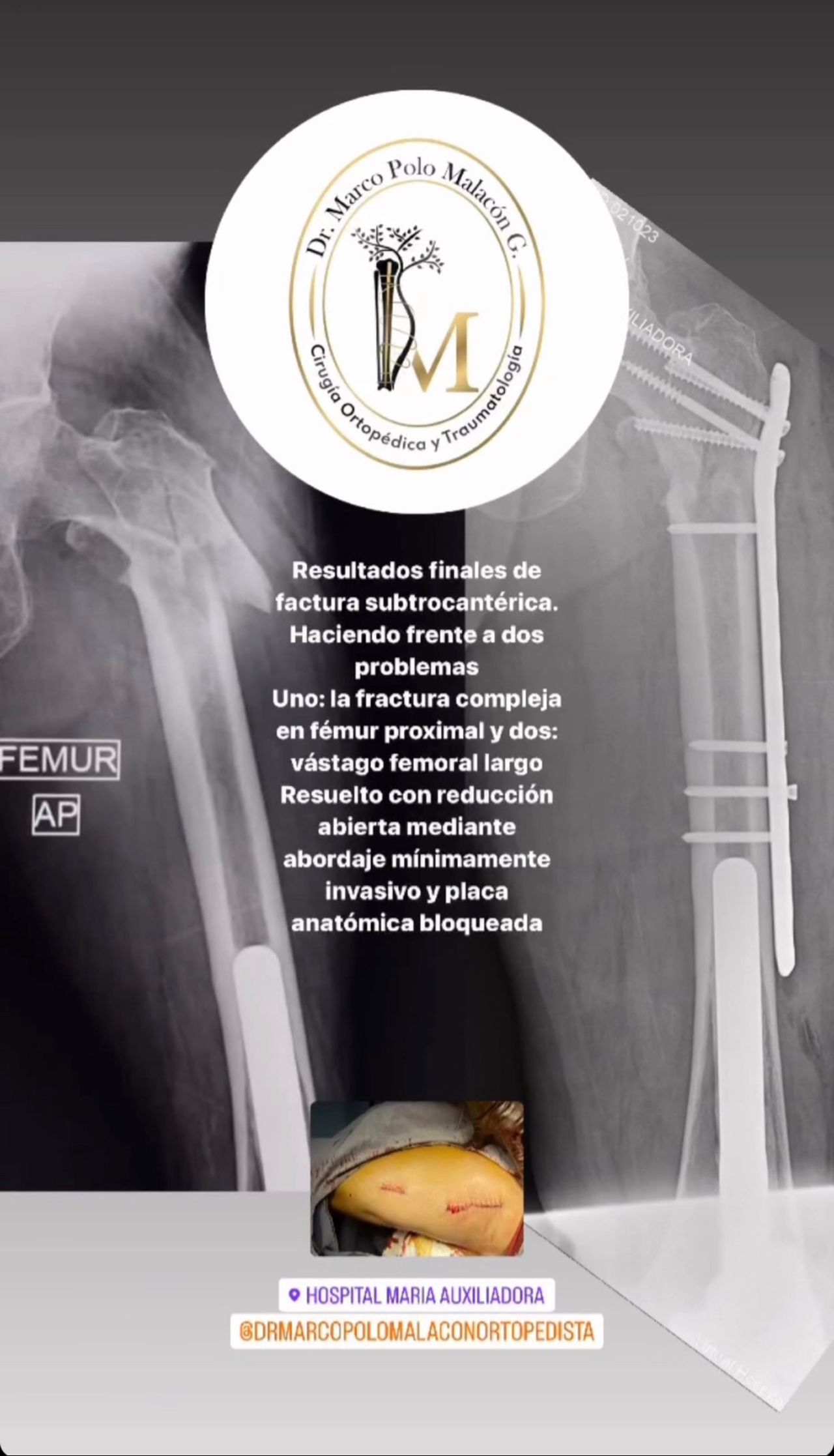 Marco Polo Malacón Gutiérrez-19