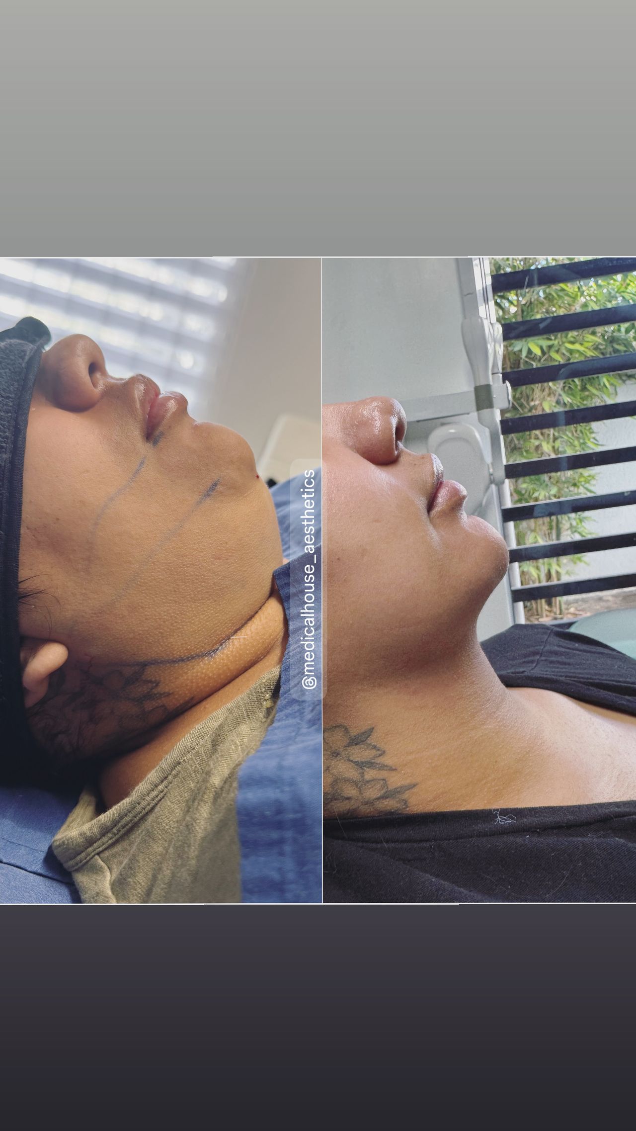 Miguel Angel Aguirre-21