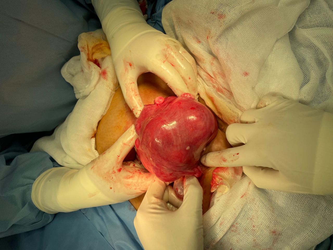 Gonzalo Hernández Martínez-44