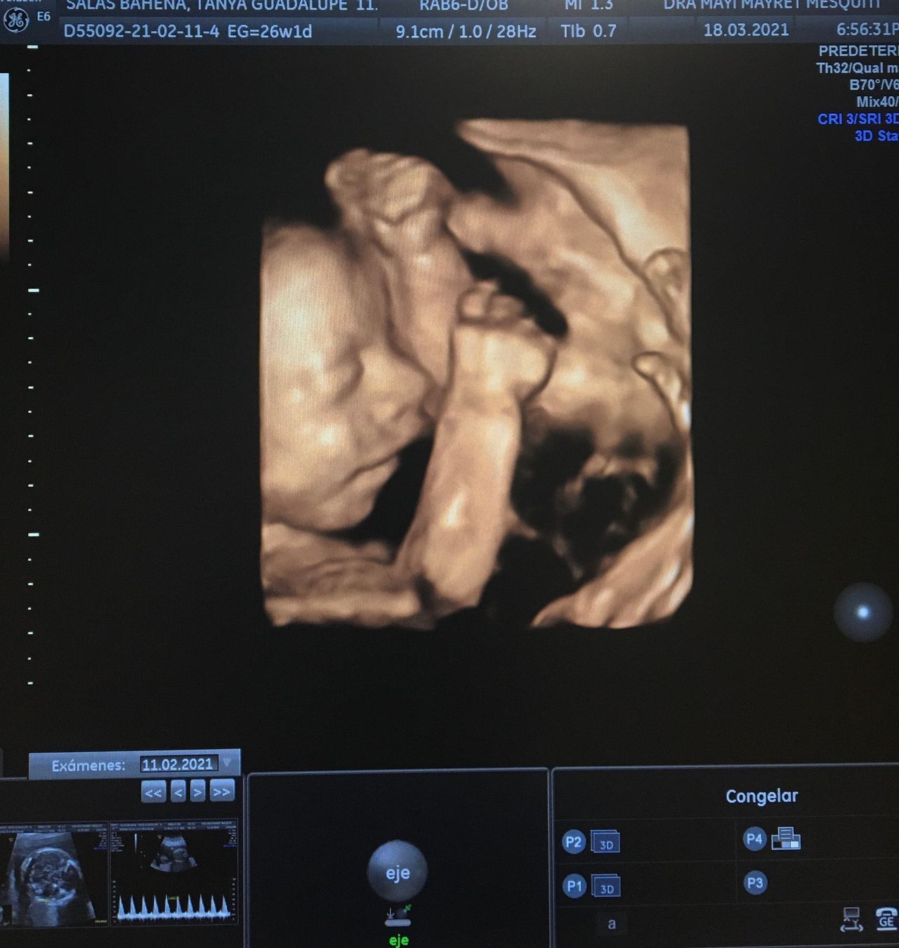 Mayi Mayret Mesquiti-22