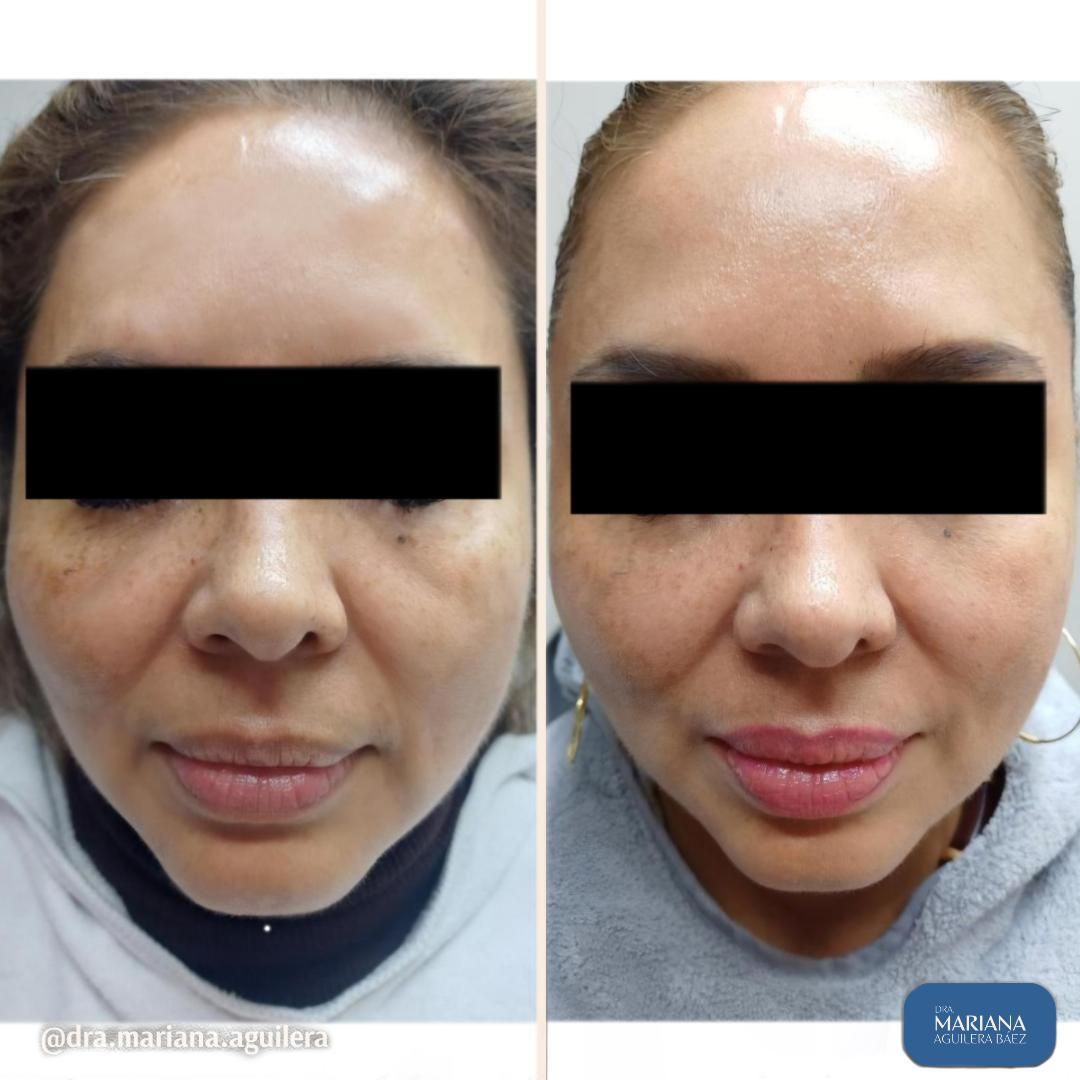 Mariana Aguilera Baez-43