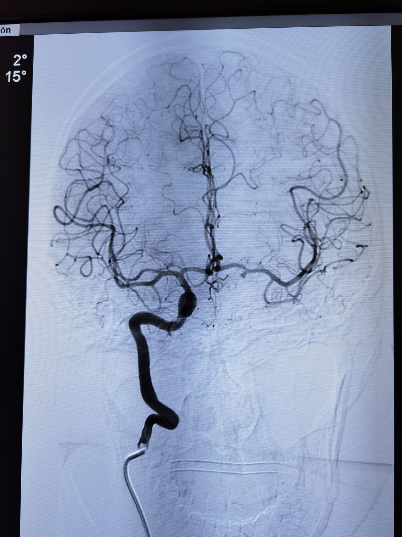 Hilario Paul Alanis Resendiz-4