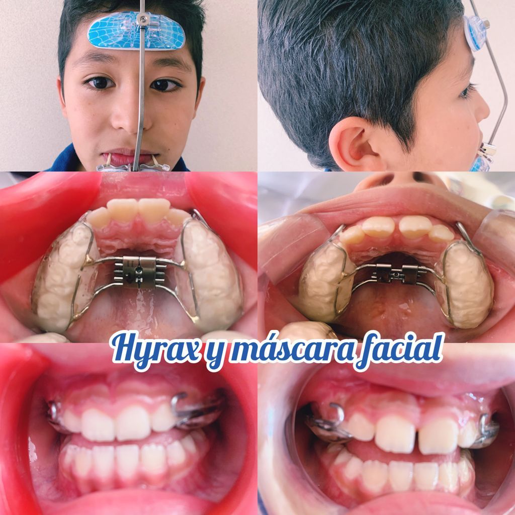 Sandra Betancourt Romero-6