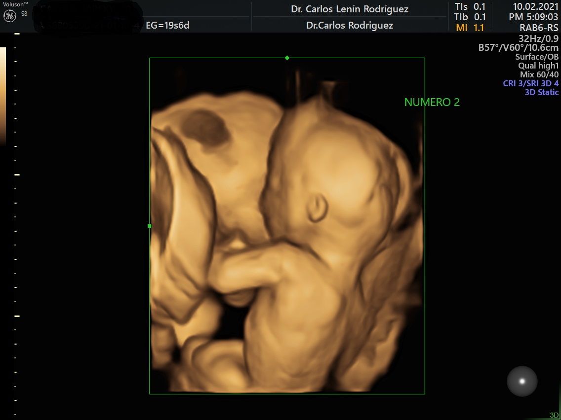 Carlos Lenin Rodriguez Mora-11