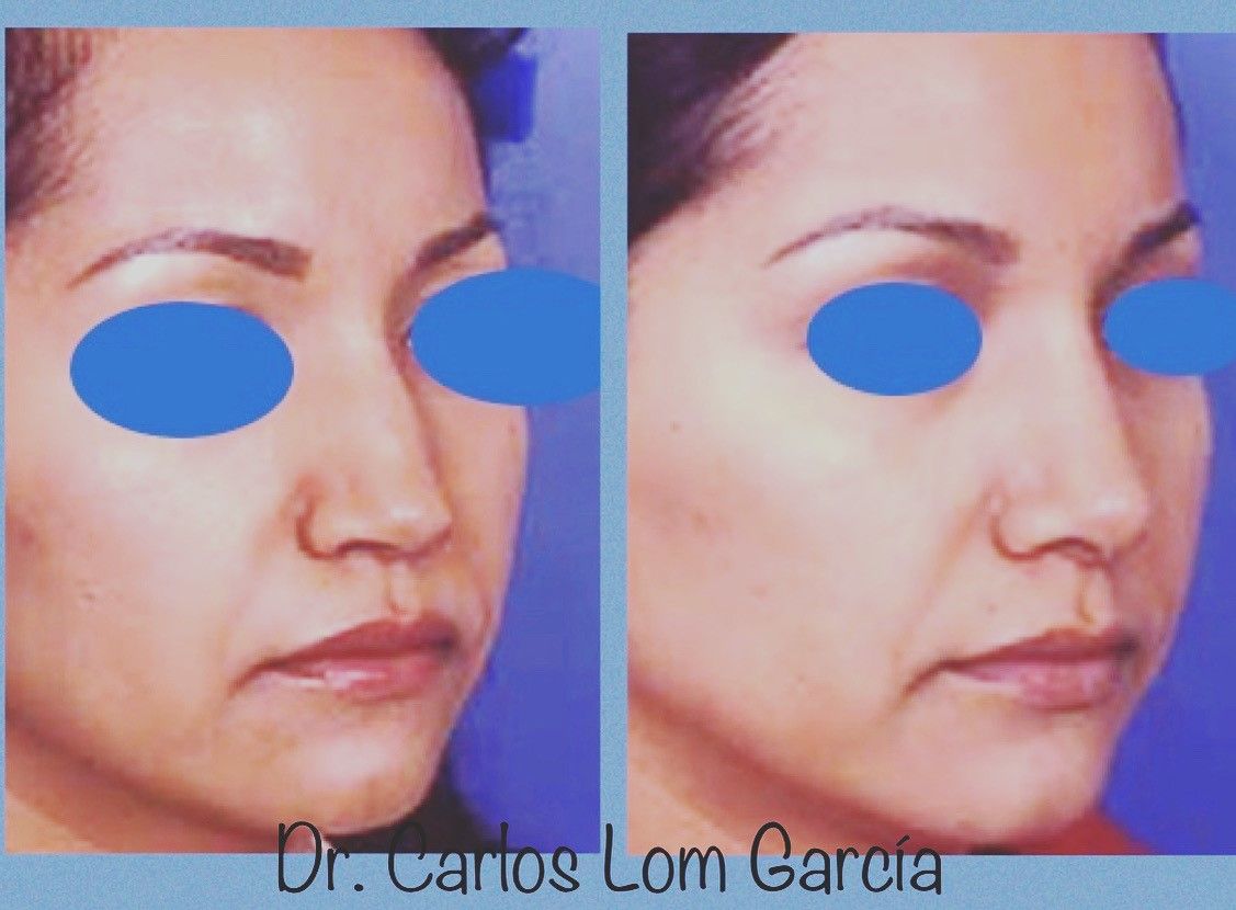 Carlos Lom García-1