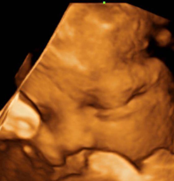 Jorge Montoya Sarmiento-7