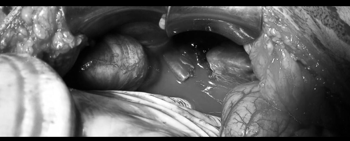 José Juan Torres Hernández-2