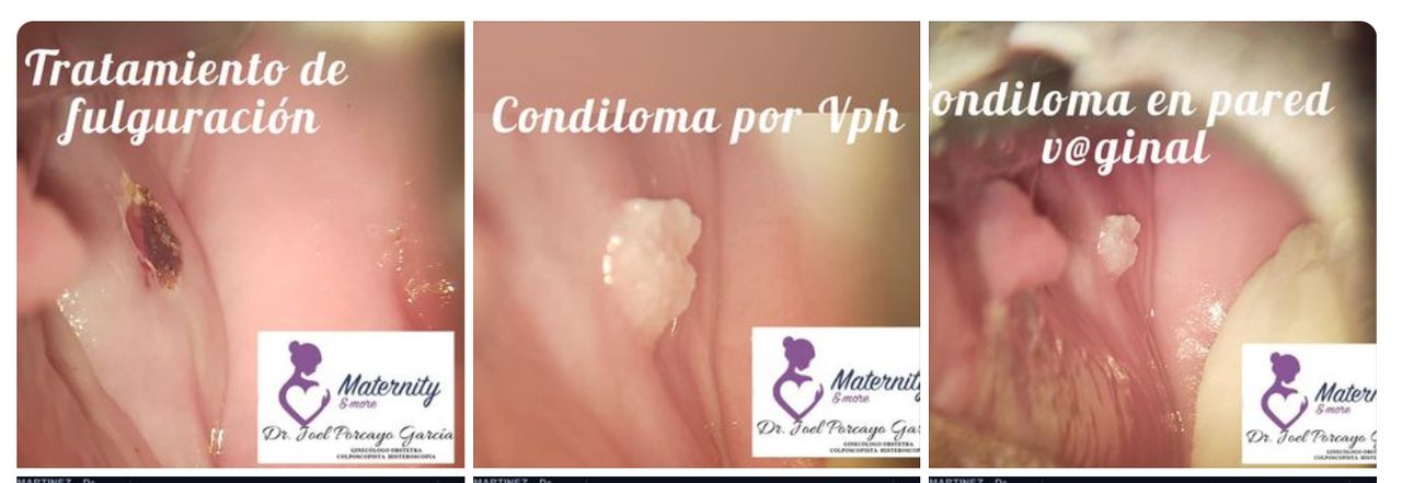 Joel Porcayo Garcia-12