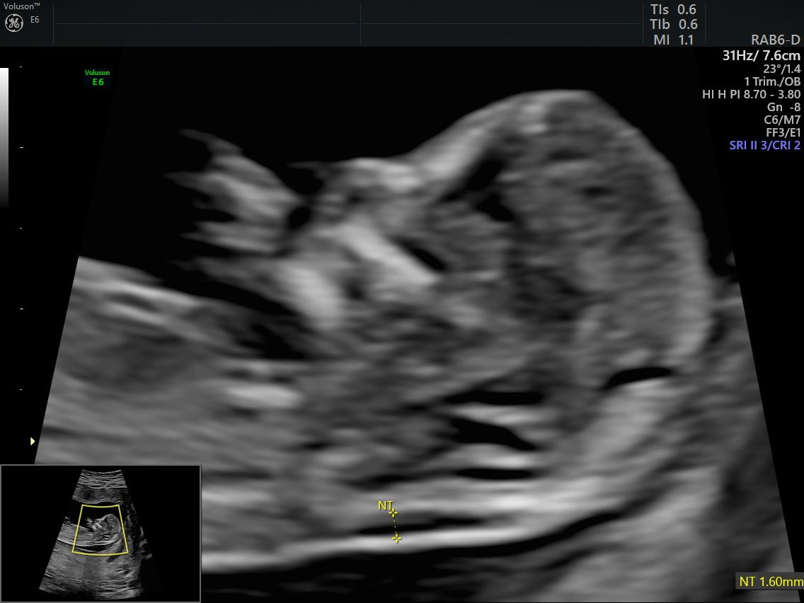 Gila Lili Barrientos Chavez-3