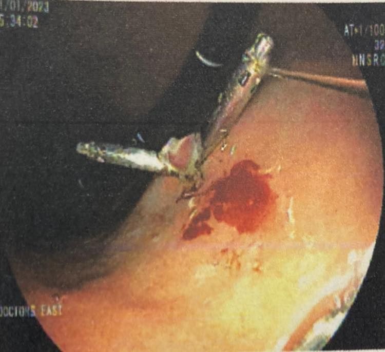 J. César Reyes Vásquez-5