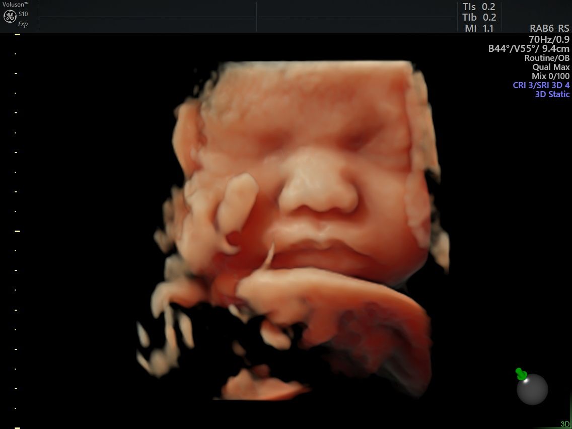 Arturo Herrera Flores-6