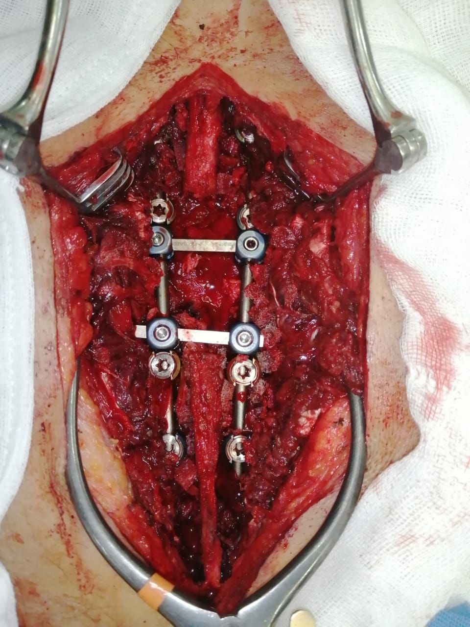 Juan José Luévano De La Cruz-25