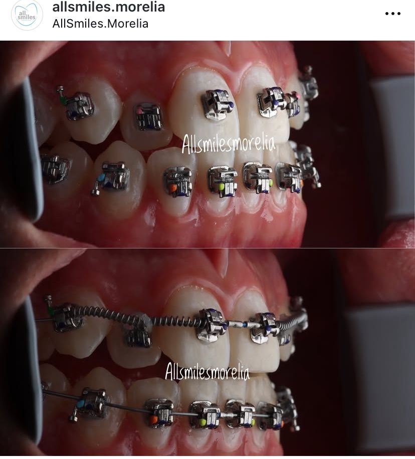 Uiquixu Flores Castro-9