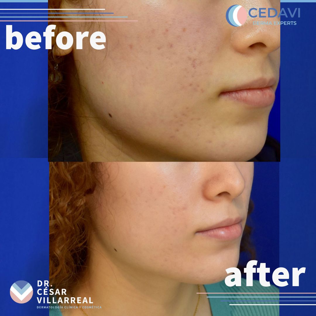 César Daniel Villarreal Villarreal-5