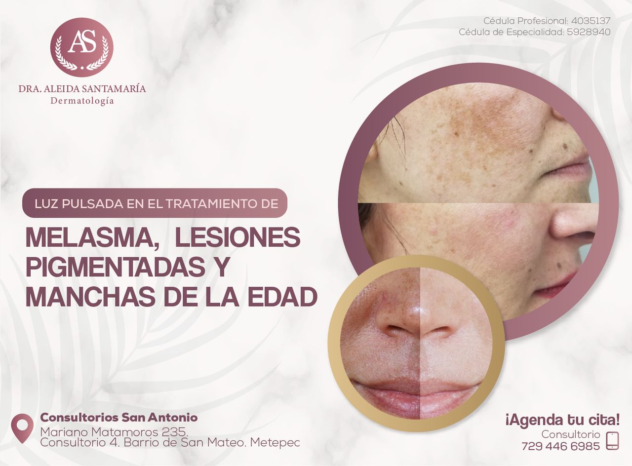 Aleida Santamaria Roman-0