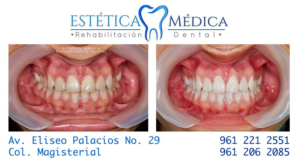 Bielmy Veronica Jonapa Peña-38