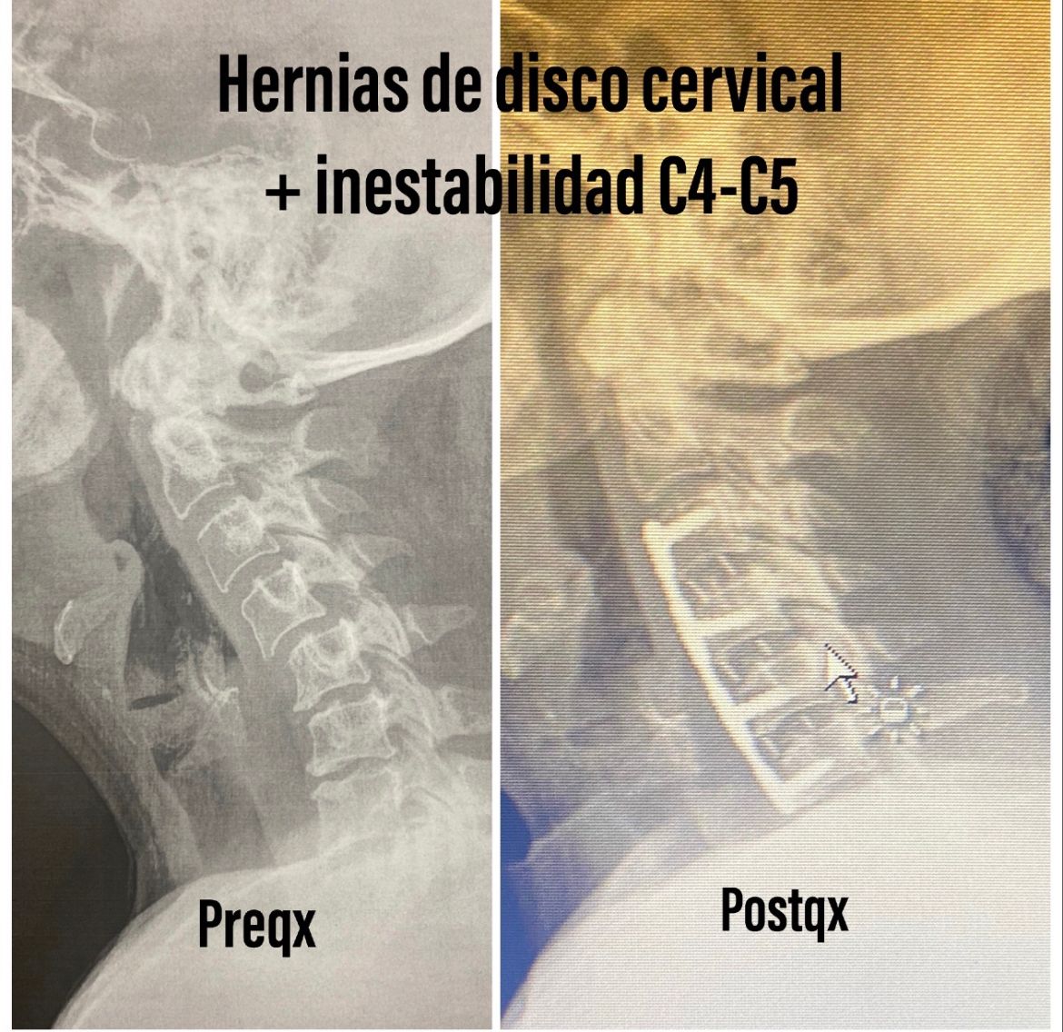 Michelle Omar Calderon Sánchez-9