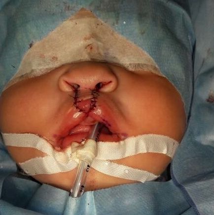 Zeyda Oliman Hoyos-8