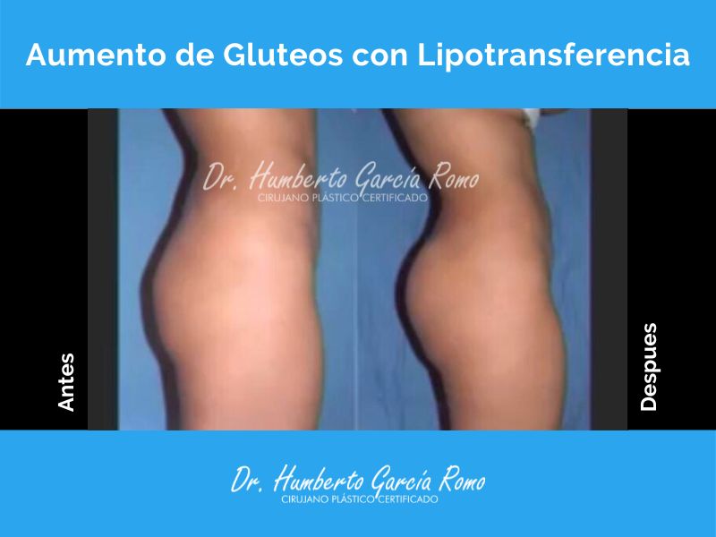 Humberto García Romo-11