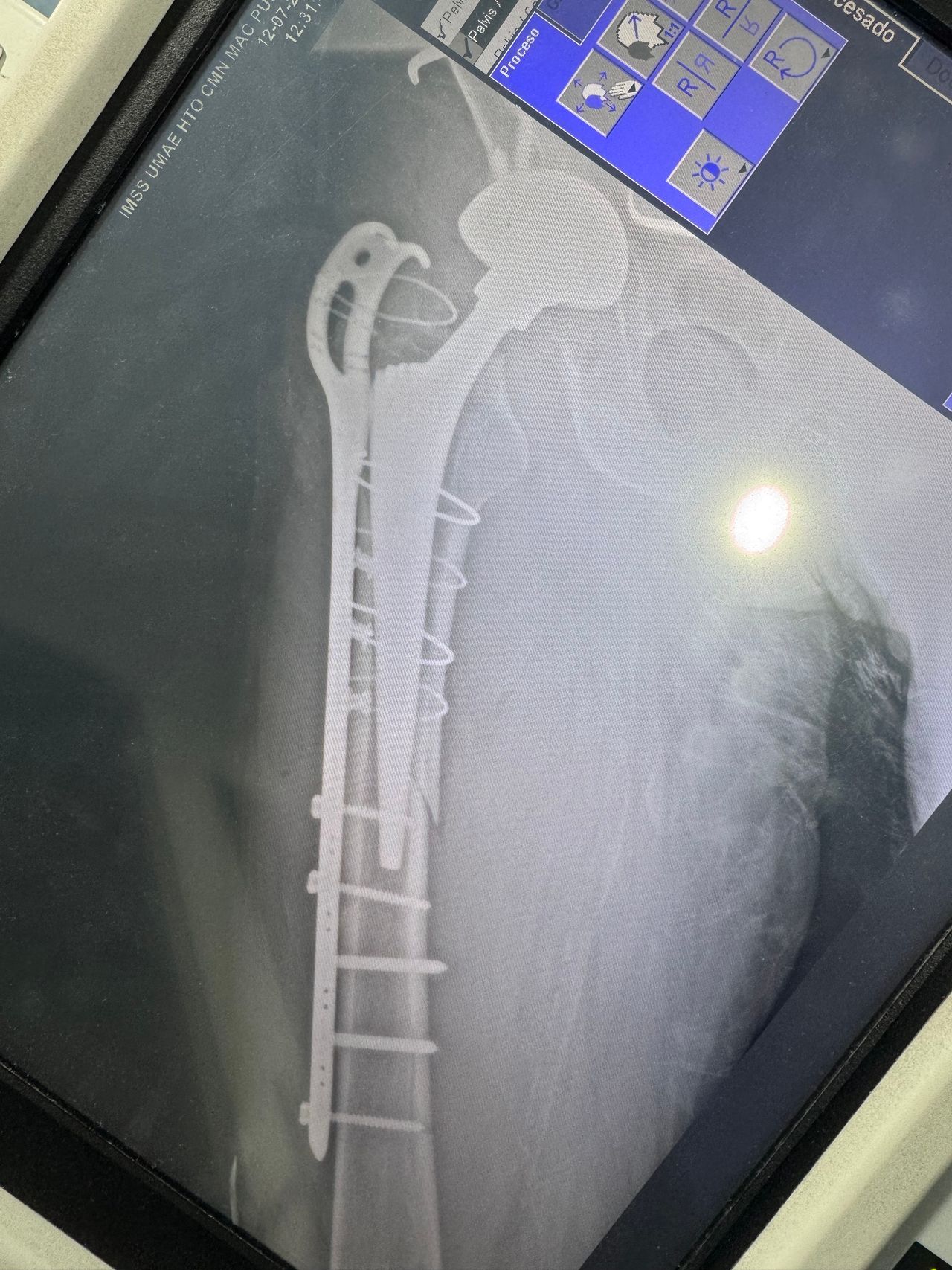 Evaristo De Jesús Castillo García-2