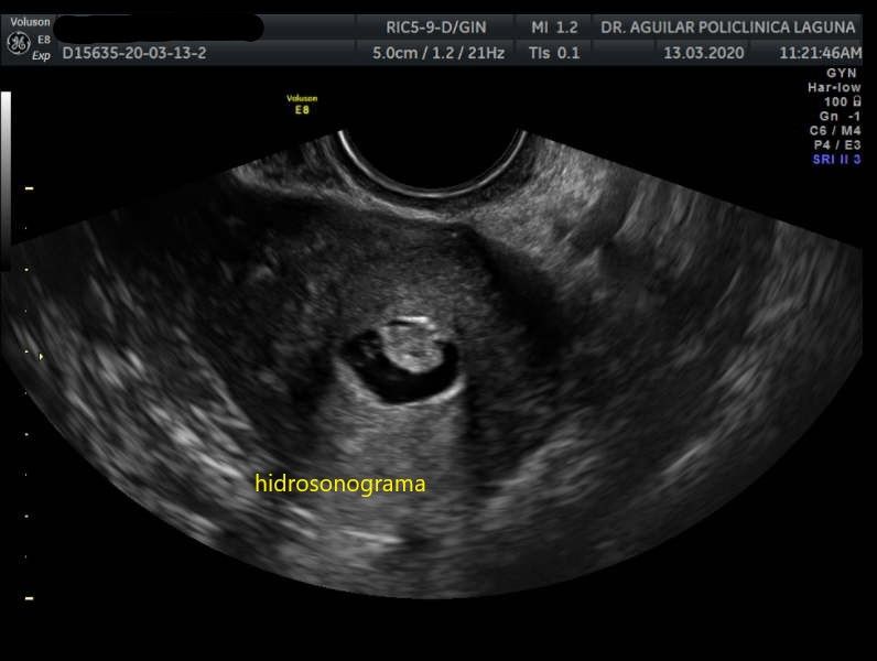 Edgar Fernando Aguilar Morales-1