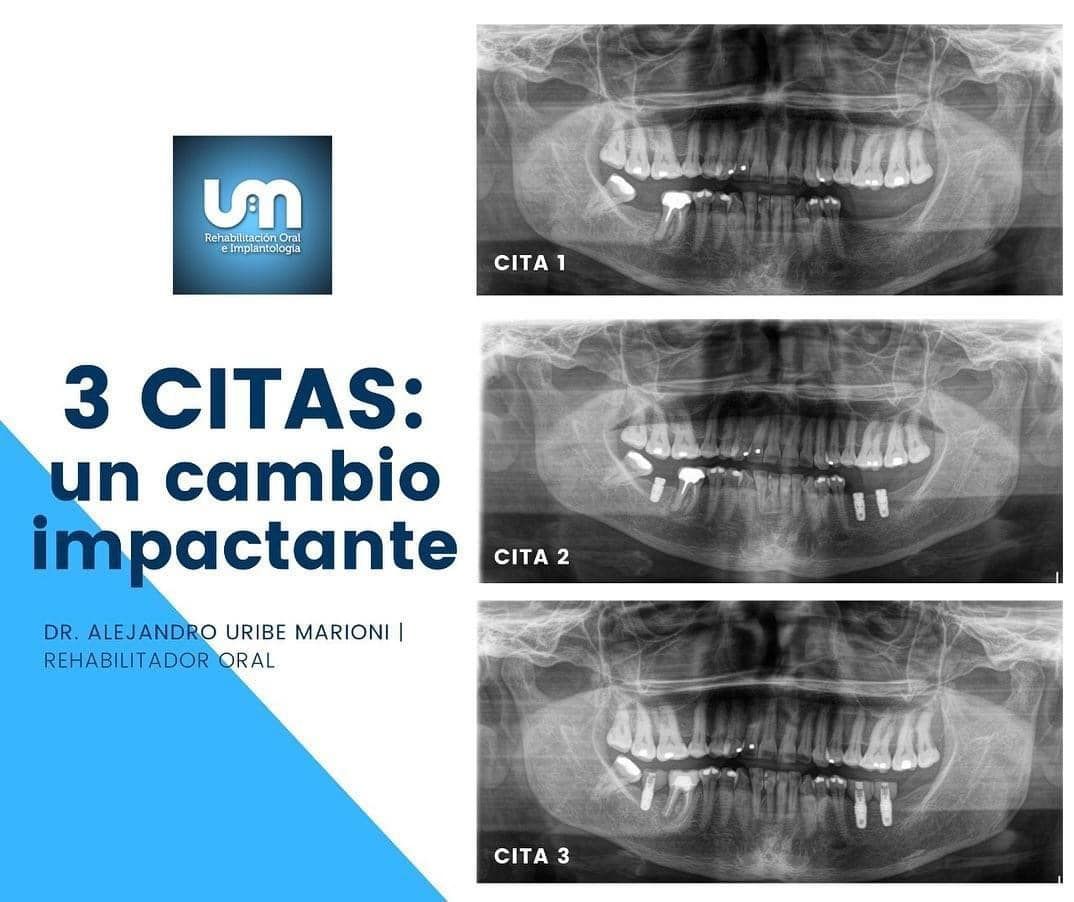 Alejandro Uribe Marioni-8