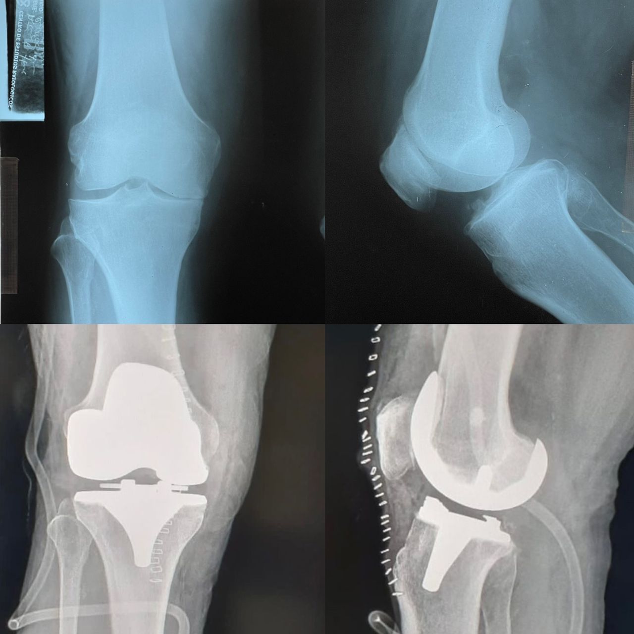 Juan Manuel Castillo Rivera-5