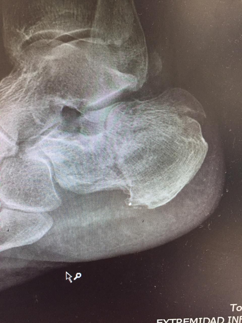 Gerardo Bautista Díaz-15